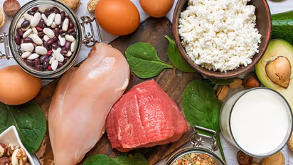 കലോറി കൂടിയ ഭക്ഷണങ്ങൾ കഴിക്കുന്നത് ആരോഗ്യത്തിന് നല്ലതല്ല; കാരണം