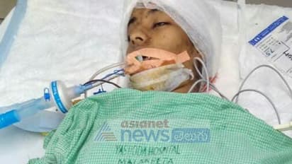 మధులికకు బ్రెయిన్ సర్జరీ అవసరం: యశోద వైద్యులు