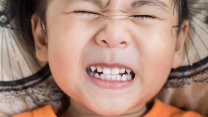 ಮಕ್ಕಳು ಖುಷಿ ಪಡುತ್ತವೆ ಅಂತ ಸಿಕ್ಕಾಪಟ್ಟೆ ಚಿಪ್ಸ್ ಕೊಟ್ಟರೆ ಹಲ್ಲು ಹಾಳಾಗುತ್ತೆ!