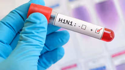 ರಾಜ್ಯಾದ್ಯಂತ ಹಂದಿಜ್ವರ ದಿಢೀರ್ ಹೆಚ್ಚಳ; 14 ಮಂದಿ ಸಾವು