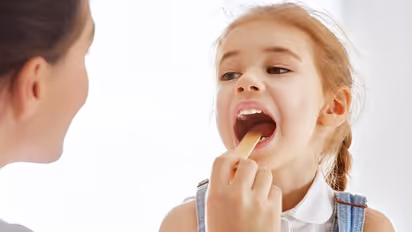 കുട്ടികളിലെ ടോണ്സിലൈറ്റിസ്; എങ്ങനെ തടയാം