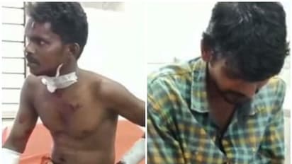 ബിജെപി ഓഫീസിന് മുന്നിലെ കുറ്റിക്കാട് വൃത്തിയാക്കുന്നതിനിടയിൽ ബോംബ് പൊട്ടി 3 പേര്ക്ക് പരിക്ക്