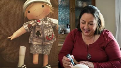 ഒരു കയ്യില്ലാത്ത, കാലില്ലാത്ത, പൊള്ളലേറ്റ പാവകള്; ആമി ഇത്തരം പാവകള് നിര്മ്മിക്കുന്നതിന് കാരണമുണ്ട്