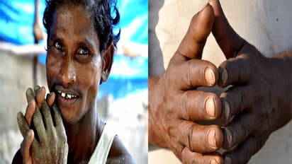 వింత అనుభవం: వేలిముద్రలు కనబడుటలేదు