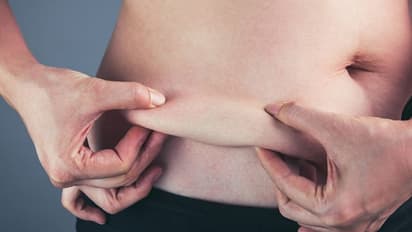 ഈ 4 ശീലങ്ങൾ മാറ്റിയാൽ അടിവയറ്റിലെ കൊഴുപ്പ് അകറ്റാം