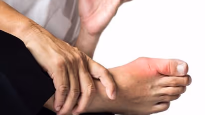 ആർത്രൈറ്റിസ് രോഗങ്ങൾ തടയാൻ സഹായിക്കുന്ന രണ്ട് തരം നട്സുകൾ