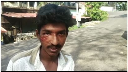 കൊല്ലത്ത് രണ്ട് പേര്ക്ക് സൂര്യാഘാതമേറ്റു