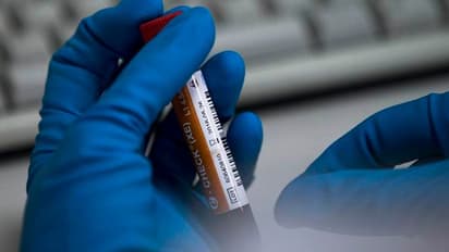 ದುಲೀಪ್ ಟ್ರೋಫಿ ವೇಳೆ ಕ್ರಿಕೆಟಿಗರಿಗೆ ಡೋಪಿಂಗ್ ಟೆಸ್ಟ್