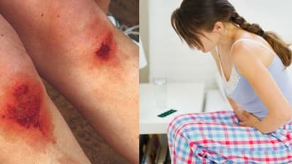 'ഫുട്ബോൾ കളിക്കുമ്പോൾ ഇതുപോലെ  മുട്ടിലെ തൊലി പോയിട്ടുണ്ടോ..? ഇല്ലെങ്കിൽ പിരിയഡ് പെയ്ൻ എന്നും പറഞ്ഞ് വന്നേക്കരുത്..'  - എന്ന് ട്വീറ്റ് ചെയ്ത യുവാവിന്  കിട്ടിയ ചുട്ട മറുപടി..!