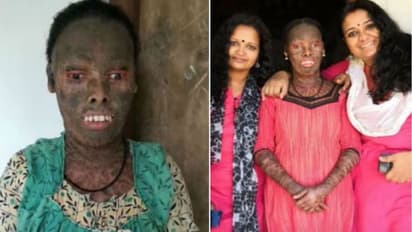 ഇനി ഈ മുഖം വാടേണ്ട; പുതിയ ജീവിതത്തിലേക്ക് പ്രീതി...