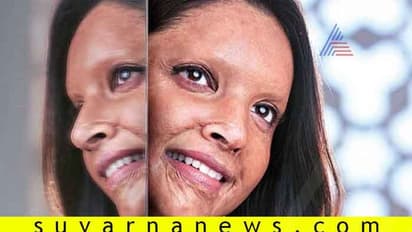 ಮಾತೇ ಬರದಂತೆ ತಡೆಯುತ್ತದೆ 'ಚಪಕ್' ಟ್ರೇಲರ್; ದೀಪಿಕಾ ಸಿಂಪ್ಲಿ ಸೂಪರ್!