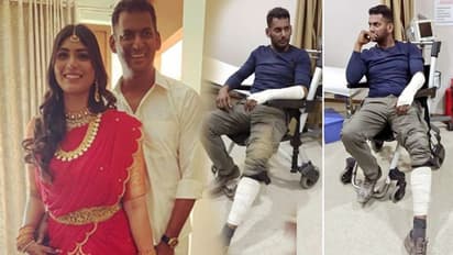 ನಿಶ್ಚಿತಾರ್ಥದ ನಂತರ ಕೈ-ಕಾಲು ಮುರಿದುಕೊಂಡ ಖ್ಯಾತ ನಟ!