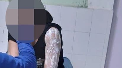 വനിത പൊലീസുകാരിക്കെതിരെ ആസിഡാക്രമണം