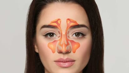 സൈനസൈറ്റിസിനെക്കുറിച്ച് അറിയേണ്ട കാര്യങ്ങള്...