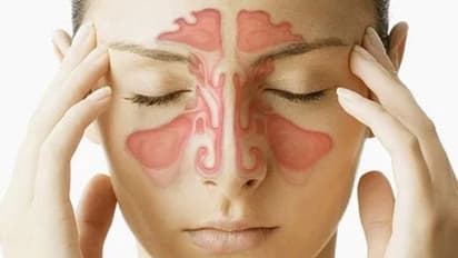 সাইনাস কী, জেনে নিন এই রোগের প্রাথমিক লক্ষণ ও প্রতিকার