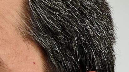 അകാലനര അകറ്റാന് ചില വഴികള്...