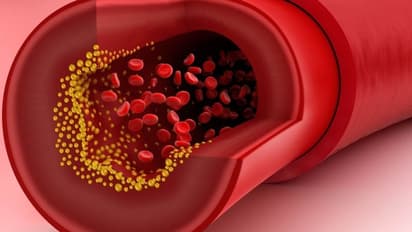 കൊളസ്ട്രോള് എപ്പോള് പരിശോധിക്കണം?