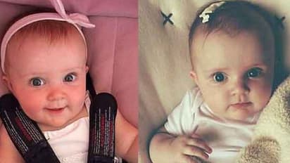 ശരീരമാകെ നീലനിറമായി, ചര്ദ്ദിച്ചു; പരിശോധനയിൽ അപൂർവ അലർജിയാണെന്ന് ഡോക്ടർമാർ കണ്ടെത്തി