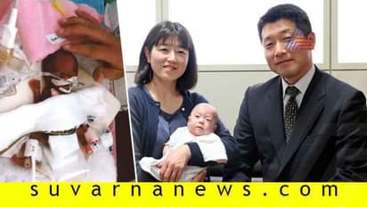 ಸೇಬು ಹಣ್ಣಿನಷ್ಟು ತೂಕವಿದ್ದ ಶಿಶು ಈಗ ಆರೋಗ್ಯಪೂರ್ಣ