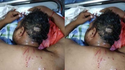 హైదరాబాద్ బీజేపీ ఉపాధ్యక్షుడిపై హత్యాయత్నం