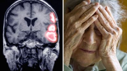 പക്ഷാഘാതവും മറവിരോഗവും പ്രതിരോധിക്കാന്‍ ഇതാ ഒരു മരുന്ന്