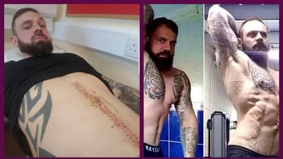 ജിമ്മില് പോക്ക് കൂടി യുവാവിന്റെ ആമാശയം തിരിഞ്ഞുപോയി.!