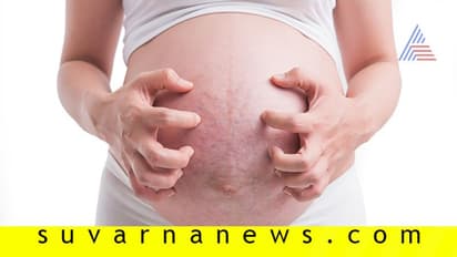 ಪ್ರಗ್ನೆನ್ಸಿ ಕುರಿತ ಈ ನಂಬಿಕೆಗಳು ನಿಜವಲ್ಲ!