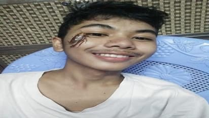 ಹಿಟ್ ಮಾಡಬೇಕಿದ್ದ ಜೀರಳೆಯನ್ನು ಮುಖದ ಮೇಲೆ ಬಿಟ್ಗೊಂಡ್ರು!