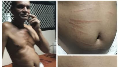 'നാളെ വയറും കാലുമൊക്കെ വെട്ടിക്കീറാന് ഉള്ളതല്ലേ..പിന്നെ ഈ ചെറിയ മുറിവുകള് കാര്യമാക്കണ്ട'; വണ്ടാനം മെഡിക്കല് കോളേജിലെ ജീവനക്കാരന് രോഗികളോട്