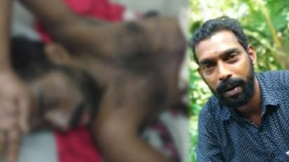 വയറുവേദനയ്ക്ക് മരുന്നു വാങ്ങി കഴിച്ചു, വൃണങ്ങള് പിടിപ്പെട്ട് ഗുരുതരാവസ്ഥയില്; അന്വേഷണം തുടങ്ങി