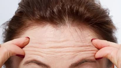 നെറ്റിയിലെ ചുളിവും ഹൃദയവും തമ്മിലുള്ള ബന്ധമിതാണ്...