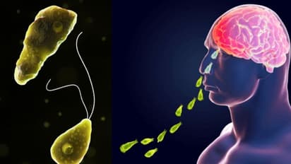 മലപ്പുറത്ത് പത്ത് വയസുകാരി മരിച്ചത് 'തലച്ചോര് തിന്നുന്ന അമീബ' മൂലം; എന്താണ് ഈ രോഗം?