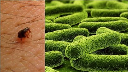 Scrub Typhus-জেলায় ছড়াচ্ছে স্ক্রাব টাইফাস, আক্রান্ত হচ্ছে শিশুরা, চিন্তায় স্বাস্থ্য দপ্তর