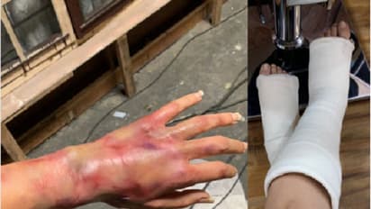 ঝুঁকি নিয়েই কাজ করতে ভালোবাসেন বলিউডের এই তারকা, শ্যুটিং-এ অসুস্থ হয়ে পোস্ট নায়িকার