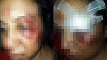 മുംബൈ മാധ്യമപ്രവര്ത്തക നിതിക റാവു ആക്രമിക്കപ്പെട്ടോ? വൈറൽ ചിത്രത്തിന് പിന്നിലെ യാഥാര്ത്ഥ്യം ഇത്