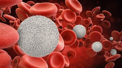 শরীরে রক্ত কম, অ্যানিমিয়ার শিকার! রক্ত ফেরাতে খাদ্য তালিকায় রাখুন এই কয়েকটি খাবার