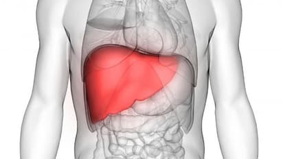 കരള് രോഗം അകറ്റാന് കഴിക്കാം ഈ ഭക്ഷണങ്ങള്