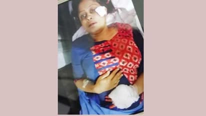 ಹಾಸನದಲ್ಲಿ ಎಇಇ ಬೆರಳು ತುಂಡರಿಸಿದ ಡಿ ಗ್ರೂಪ್ ನೌಕರ