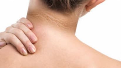 കഴുത്തിന് ചുറ്റുമുള്ള കറുപ്പ് അകറ്റാൻ ഇതാ 3 ഈസി ടിപ്സ്...