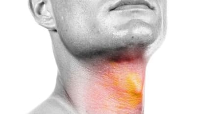 Throat Cancer: Understanding the ailment and treatment options