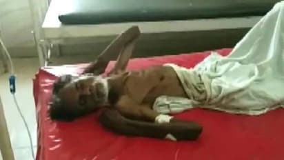 ಉಸಿರಾಡುತ್ತಿದ್ದ ವೃದ್ಧನನ್ನು ಮೃತನೆಂದು ಘೋಷಿಸಿ ಪೋಸ್ಟ್ ಮಾರ್ಟಂಗೆ ಕಳುಹಿಸಿದ ವೈದ್ಯ!