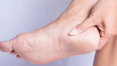 பாத வெடிப்பு வராமல் முற்றிலும் தடுக்க சூப்பர் ஐடியா இதோ...!