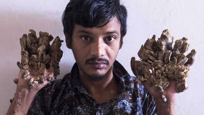 വേദന സഹിച്ച് മടുത്തു, കൈകള് മുറിച്ചുകളയൂവെന്ന അപേക്ഷയോടെ ഒരു യുവാവ്