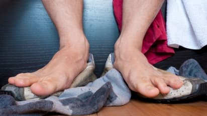 জুতো খুললেই বিশ্রী দুর্গন্ধ! অতিরিক্ত পা-ঘামা থেকে বাঁচবেন কী ভাবে