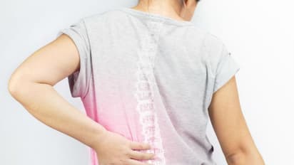 Osteoporosis : ഓസ്റ്റിയോപൊറോസിസ്: ഈ അവസ്ഥ തടയുന്നതിന് കഴിക്കേണ്ടതും ഒഴിവാക്കേണ്ടതുമായ ഭക്ഷണങ്ങൾ