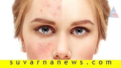 ಸ್ಕಿನ್ ಡ್ಯಾಮೇಜ್ ಮಾಡೋ ರಾತ್ರಿ ತಪ್ಪುಗಳು!