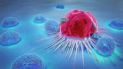 കരുതിയിരിക്കുക, ഈ ഭക്ഷണങ്ങള്ക്ക് പുറകിൽ ക്യാൻസർ ഒളിഞ്ഞിരിപ്പുണ്ട്...