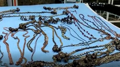 তরুণীর পেটে দু' কেজি গয়না, অস্ত্রোপচারে মিলল হাত ঘড়ি, কয়েনও