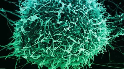 New Ebola virus : కాంగోలో కొత్త ఎబోలా వైర‌స్.. ఒక‌రు మృతి.. 