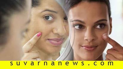 ವದನದ ಕಲೆಗೆ ಆಲೂ ರಸವೆಂಬ ಸೌಂದರ್ಯ ವರ್ಧಕ!